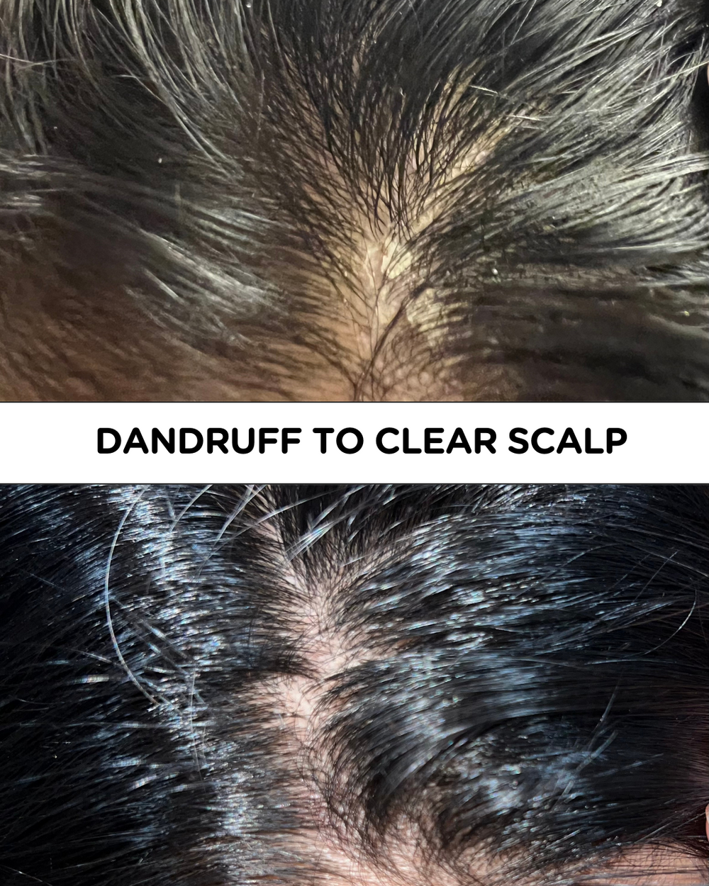 Customer-submitted before-and-after comparison of scalp appearance.