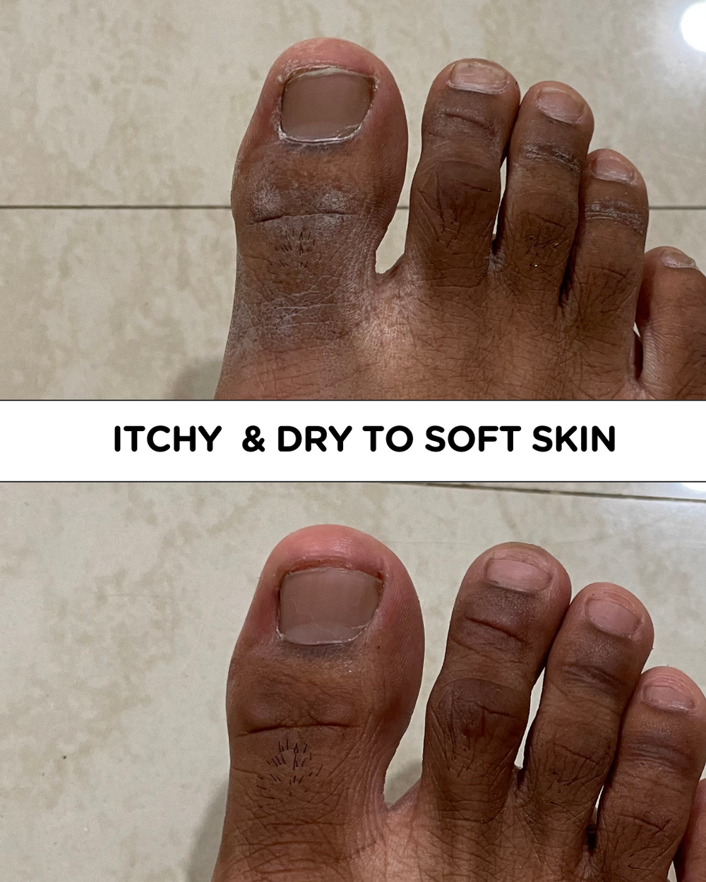 Customer-submitted before-and-after comparison of dry skin appearance.