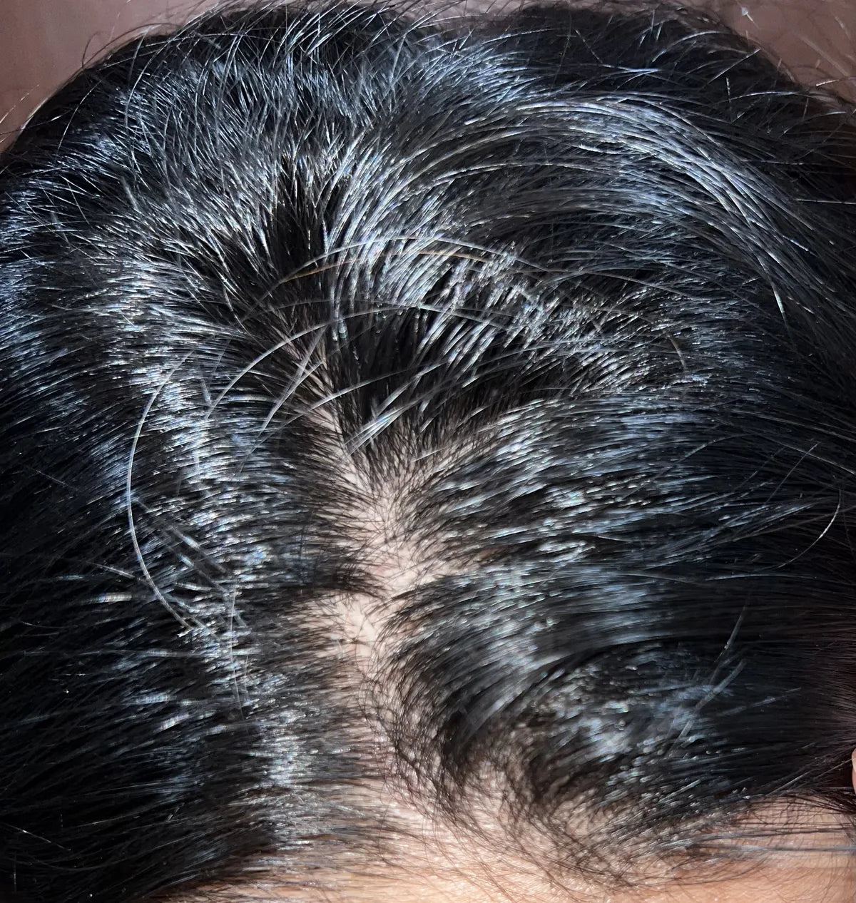 Customer-submitted after view of scalp appearance.
