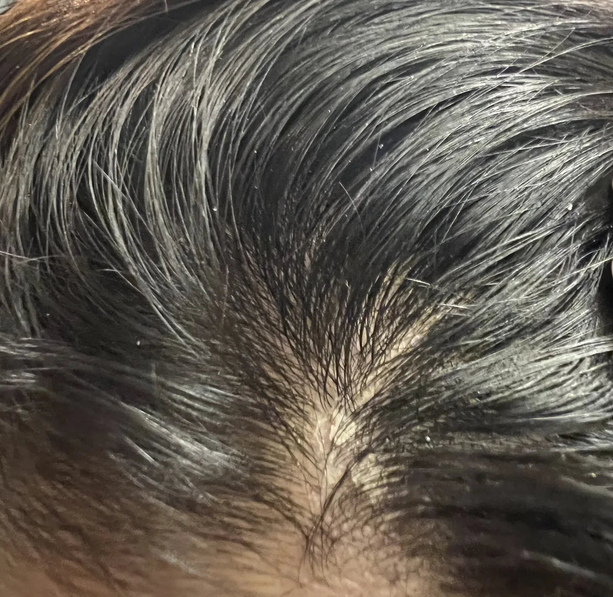 Customer-submitted before view of scalp appearance.