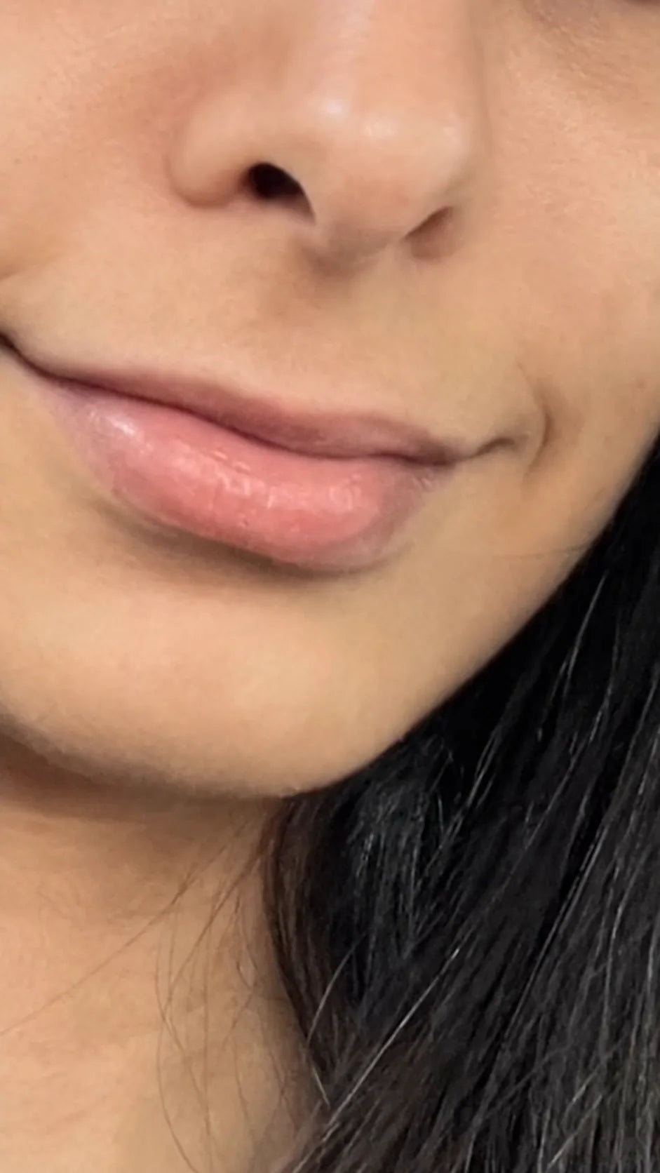 Customer-submitted after view of lower-face skin appearance.