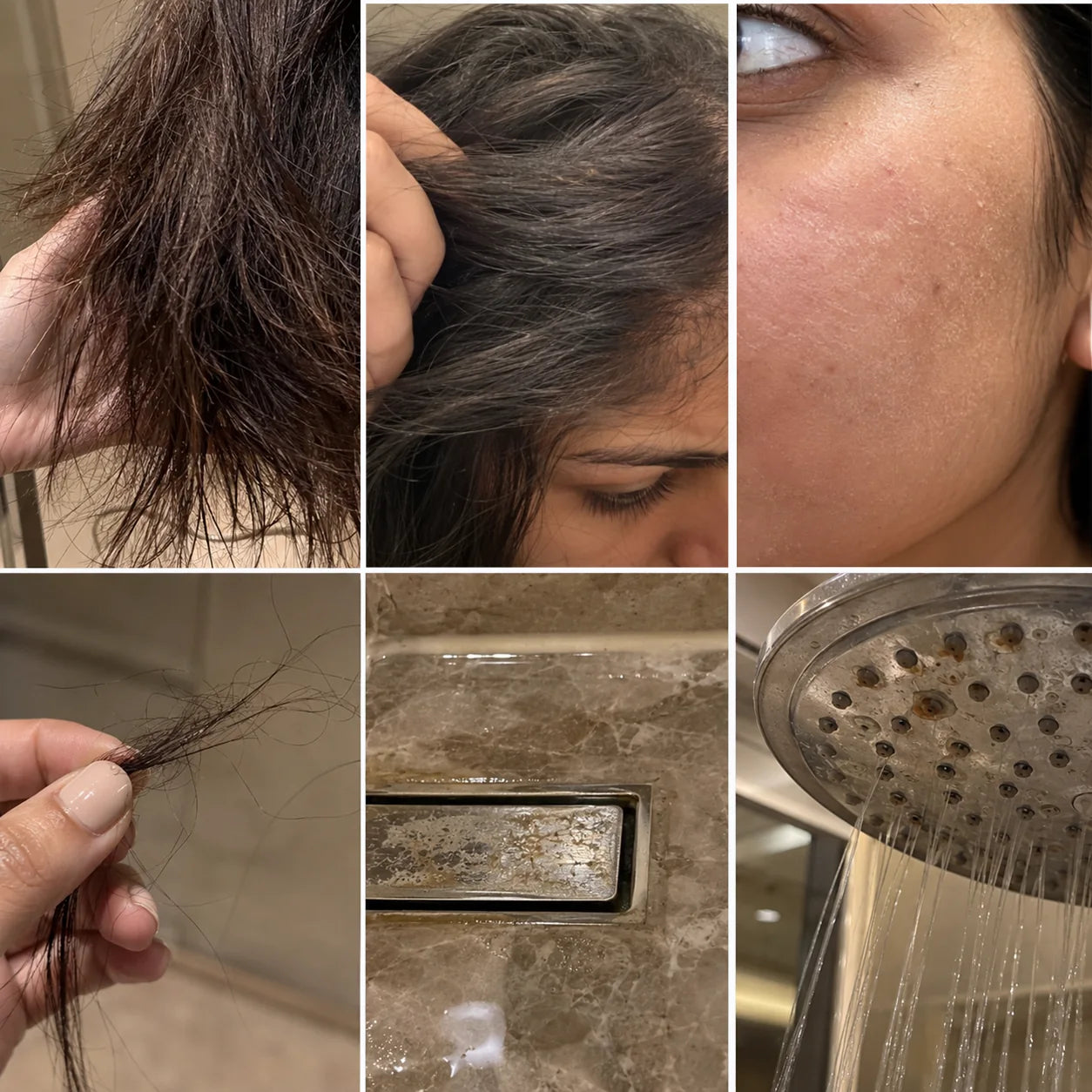 Collage showing dry hair, scalp flaking, skin texture, hair fall and mineral buildup around a shower.